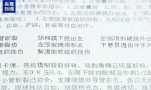 男子好心让同事“搭便车”却出车祸,被索赔十几万元,法院判决:“好意同乘”,酌情轻判